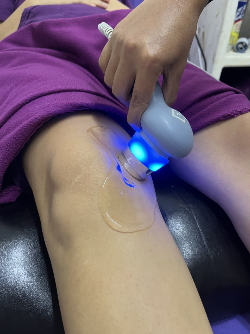 Ultrasonido Terapéutico Focalizado - Carolina Villegas Fisioterapia